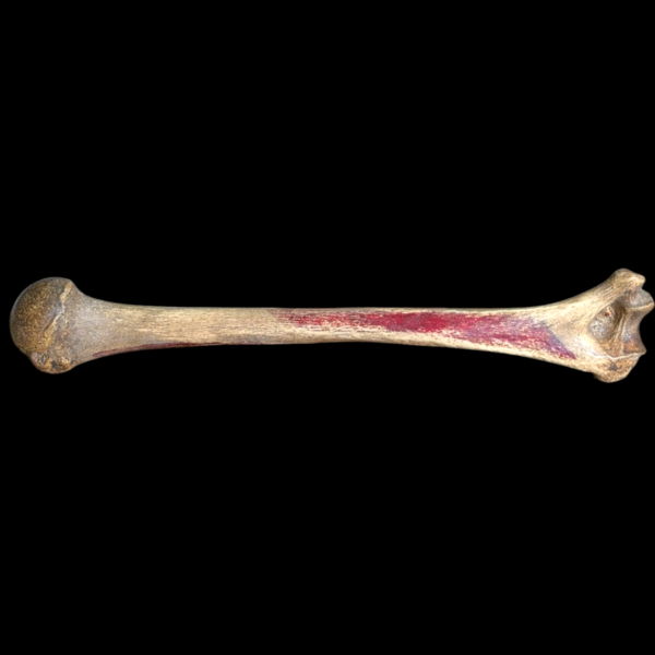 Real Human Medical Femur