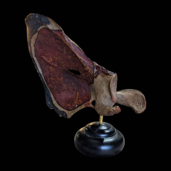 Real Human Scapula