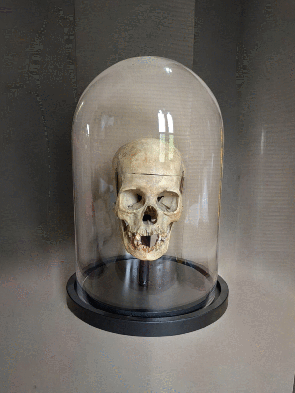 Real Human Female Medical Skull Under Glass Dome - Image 4