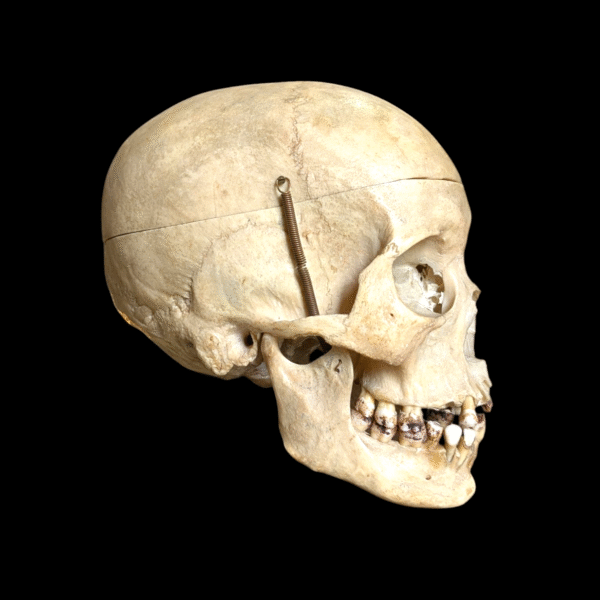 Real Human Female Medical Skull Under Glass Dome - Image 3