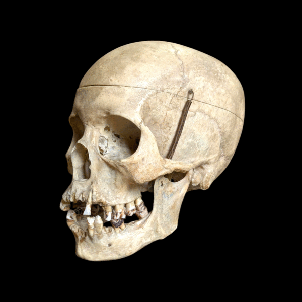 Real Human Female Medical Skull Under Glass Dome - Image 2