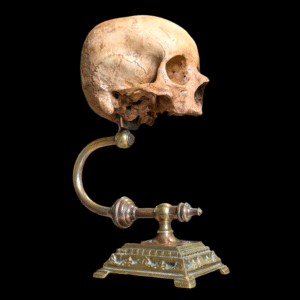 Rare Deformed Real Human Skull on Ornate Brass Anatomical Stand