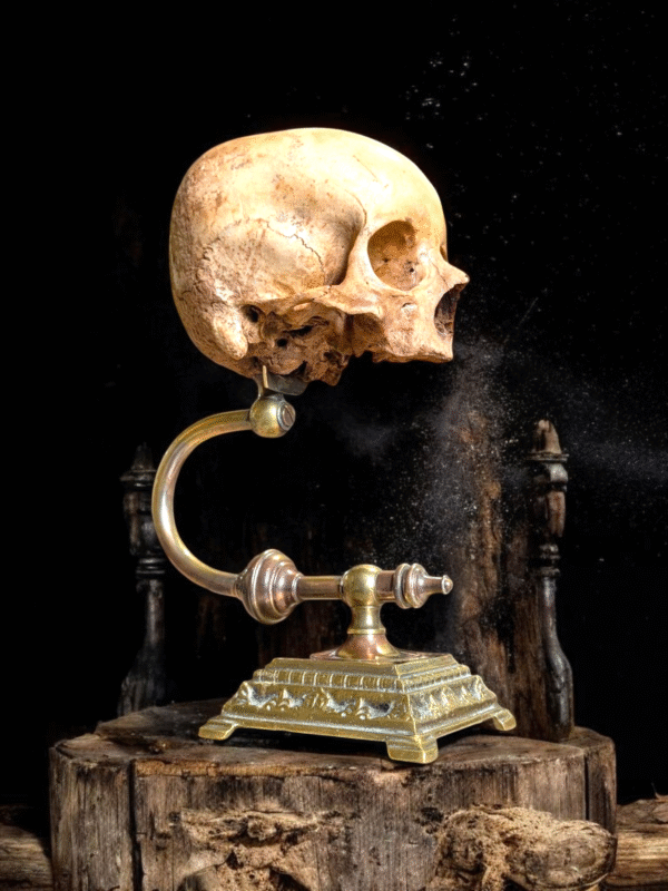 Rare Deformed Real Human Skull on Ornate Brass Anatomical Stand - Image 6