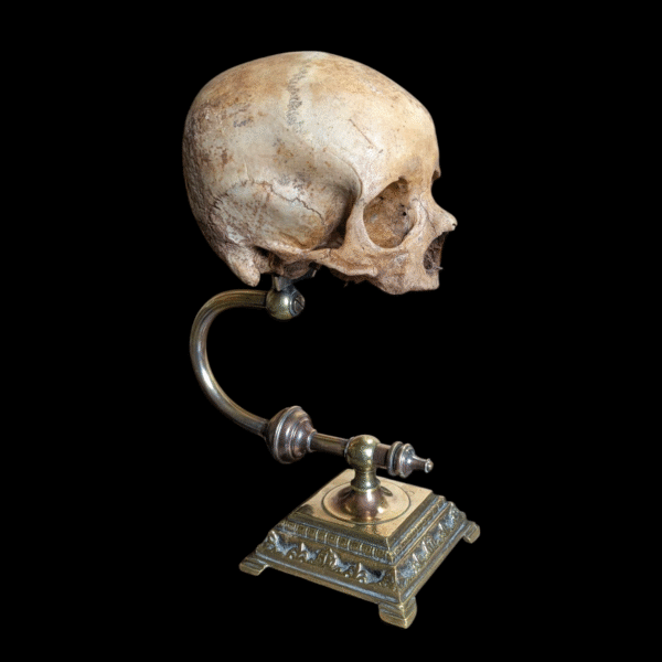 Rare Deformed Real Human Skull on Ornate Brass Anatomical Stand - Image 4