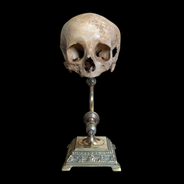Rare Deformed Real Human Skull on Ornate Brass Anatomical Stand - Image 3