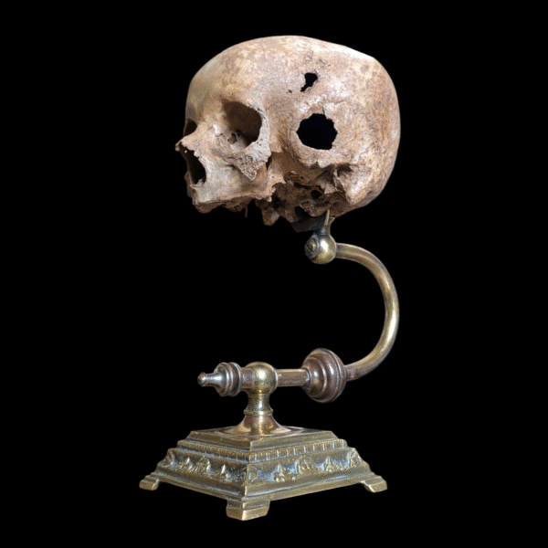 Rare Deformed Real Human Skull on Ornate Brass Anatomical Stand - Image 2