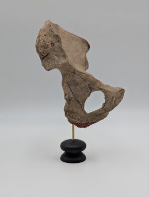 Large Ex Medical Mounted Human Pelvis Bone