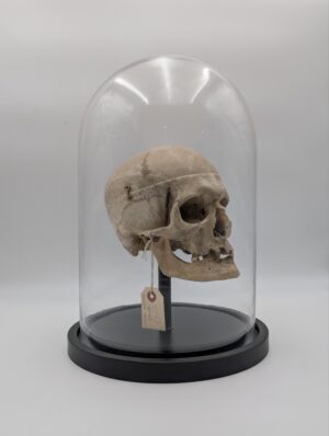 Antique Human Medical Skull Under Glass Dome – Anatomical Study Specimen Display
