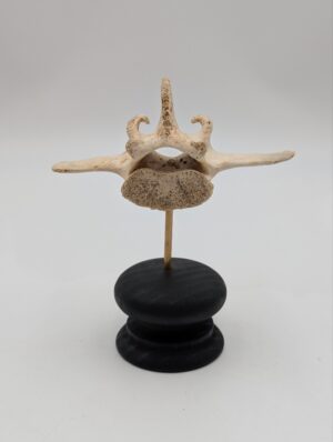 Authentic Human Vertebra Specimen on Display Stand