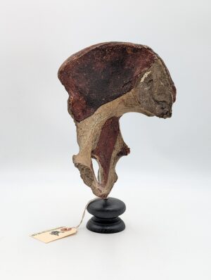 Authentic Ex-Medical Human Pelvis Specimen on Display Stand