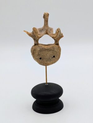 Authentic Human Vertebra Bone Specimen on Display Stand
